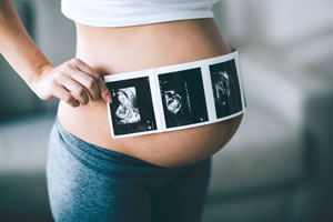 《女人春季养生要注意什么》