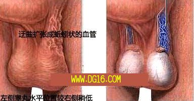 ഺڵľʲô