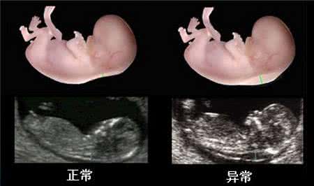 ̥NT飬֪١