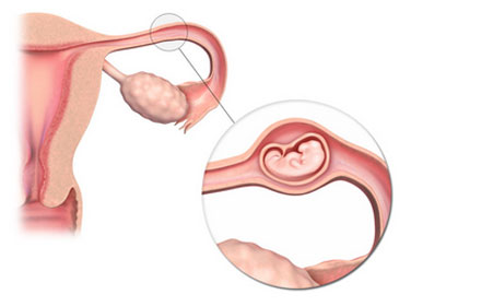 ���������е�ԭ�����������