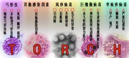 TORCHɸ11ʡ