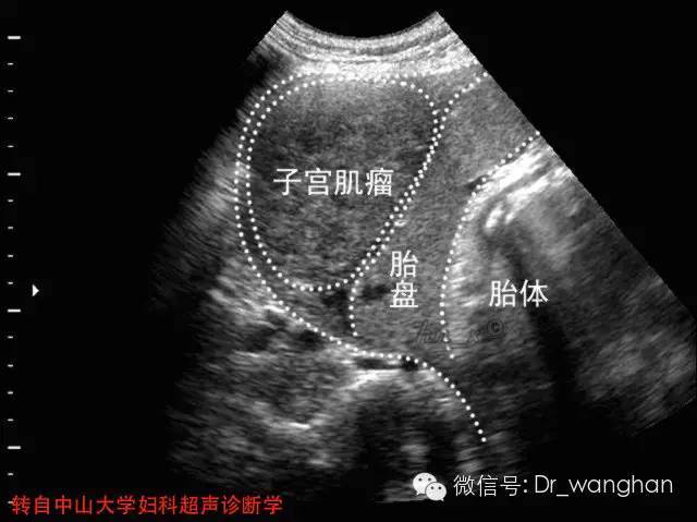 ���ӹ��������ټ�������ϡ�